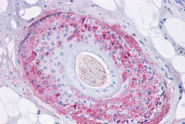 GHSR Antibody in Immunohistochemistry (Paraffin) (IHC (P))