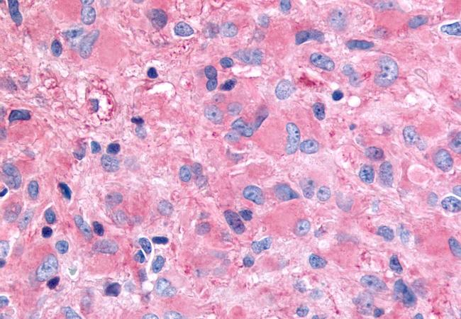 GHSR Antibody in Immunohistochemistry (Paraffin) (IHC (P))