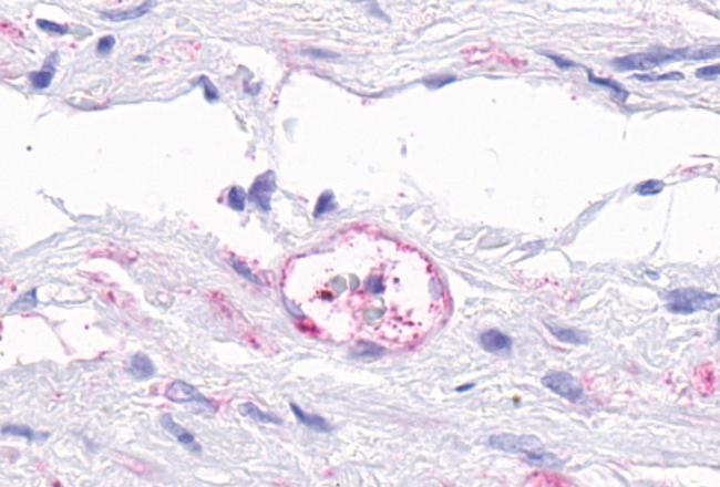 TEM5 Antibody in Immunohistochemistry (Paraffin) (IHC (P))