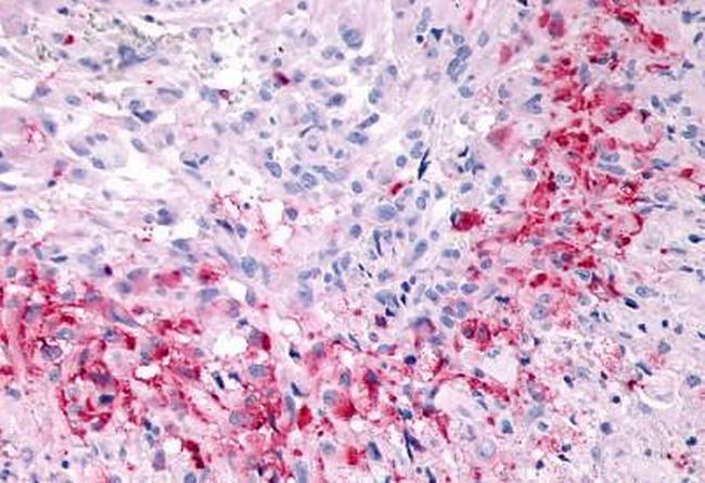 GPR133 Antibody in Immunohistochemistry (Paraffin) (IHC (P))