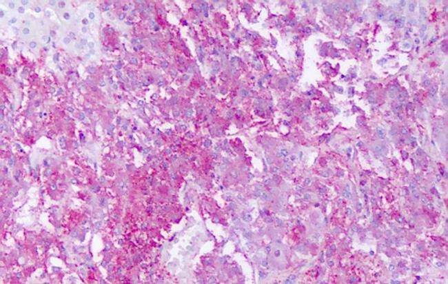 GPR161 Antibody in Immunohistochemistry (Paraffin) (IHC (P))