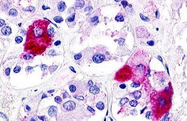 GPR21 Antibody in Immunohistochemistry (Paraffin) (IHC (P))