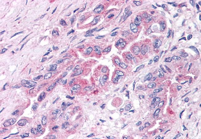 GPR30 Antibody in Immunohistochemistry (Paraffin) (IHC (P))