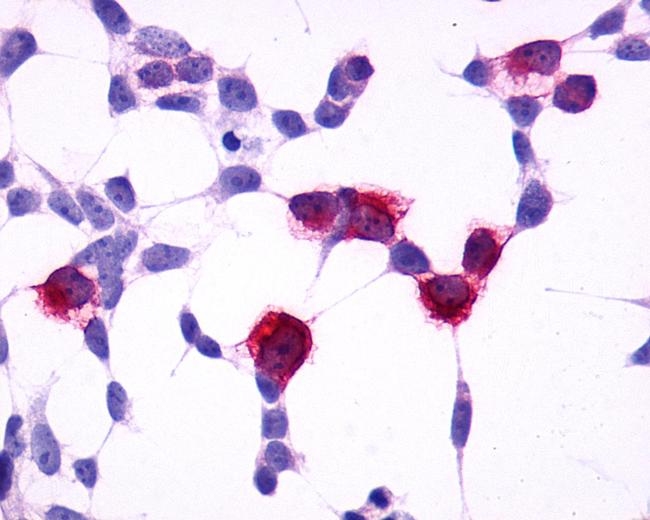 GPR4 Antibody in Immunocytochemistry (ICC/IF)