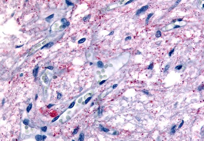 GPR50 Antibody in Immunohistochemistry (Paraffin) (IHC (P))