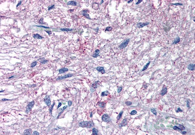 GPR50 Antibody in Immunohistochemistry (Paraffin) (IHC (P))