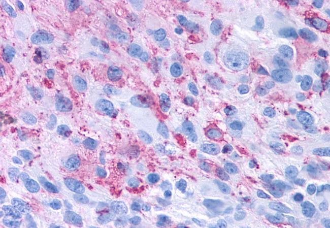 GPR50 Antibody in Immunohistochemistry (Paraffin) (IHC (P))