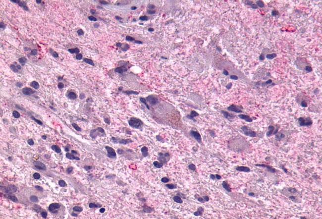 GPR55 Antibody in Immunohistochemistry (Paraffin) (IHC (P))