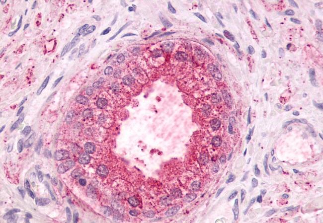 GPR55 Antibody in Immunohistochemistry (Paraffin) (IHC (P))