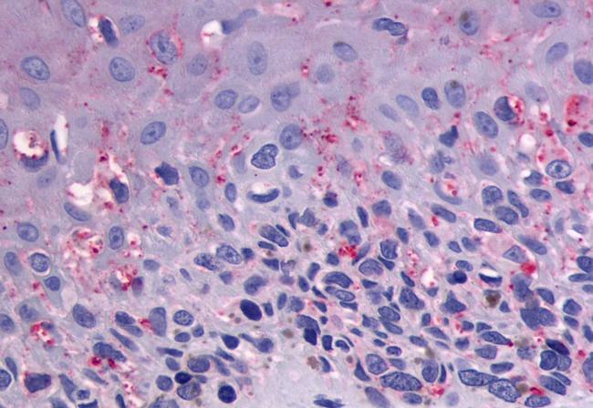 GPR56 Antibody in Immunohistochemistry (Paraffin) (IHC (P))