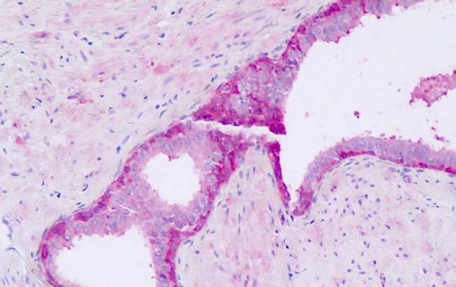 GPR56 Antibody in Immunohistochemistry (Paraffin) (IHC (P))