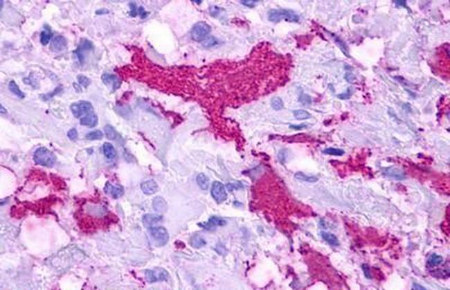 GPR84 Antibody in Immunohistochemistry (Paraffin) (IHC (P))