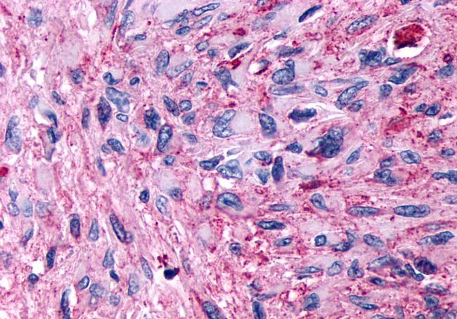 GPR89A Antibody in Immunohistochemistry (Paraffin) (IHC (P))