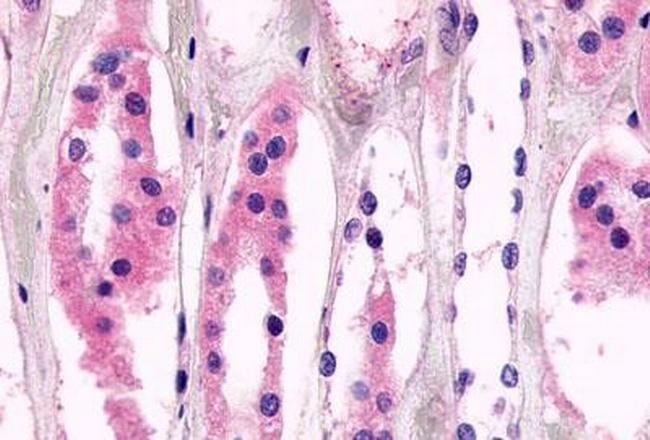 GPR98 Antibody in Immunohistochemistry (Paraffin) (IHC (P))