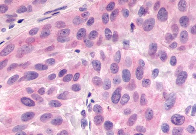 GPR98 Antibody in Immunohistochemistry (Paraffin) (IHC (P))