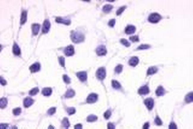 RAI3 Antibody in Immunocytochemistry (ICC/IF)