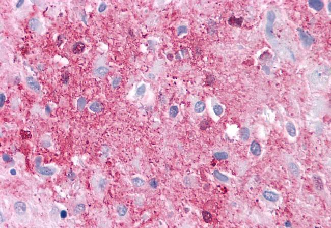 RAI3 Antibody in Immunohistochemistry (Paraffin) (IHC (P))