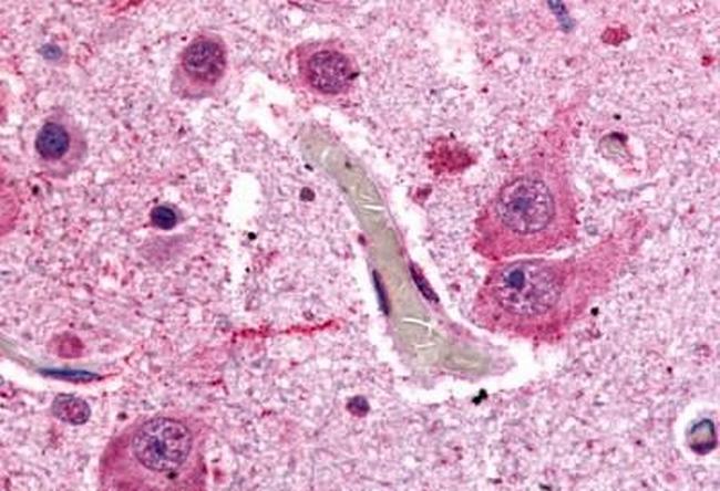 mGluR1 Antibody in Immunohistochemistry (Paraffin) (IHC (P))