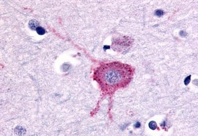 mGluR2 Antibody in Immunohistochemistry (Paraffin) (IHC (P))