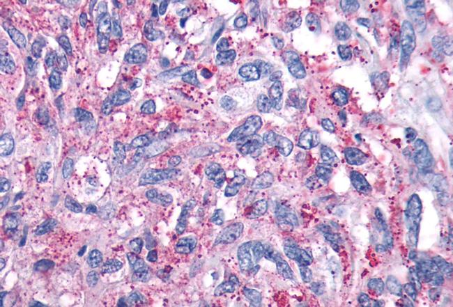 mGluR4 Antibody in Immunohistochemistry (Paraffin) (IHC (P))