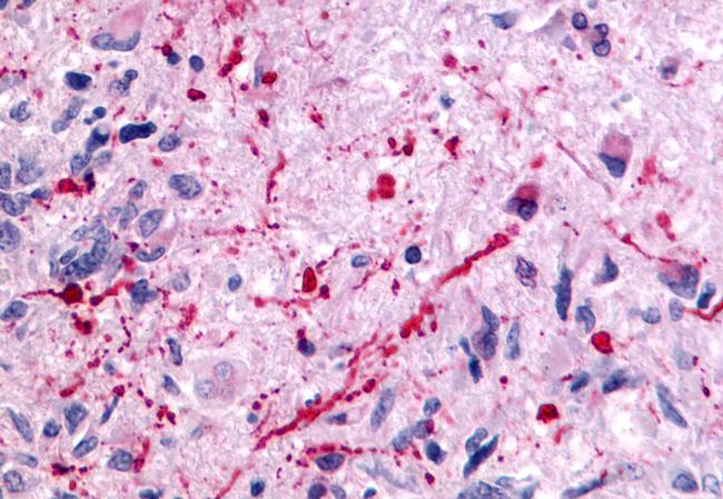 mGluR5 Antibody in Immunohistochemistry (Paraffin) (IHC (P))