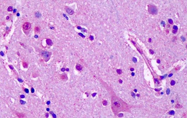 mGluR7 Antibody in Immunohistochemistry (Paraffin) (IHC (P))