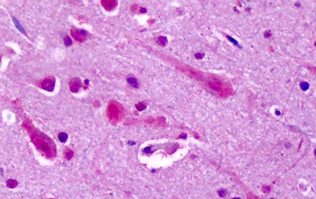 mGluR7 Antibody in Immunohistochemistry (Paraffin) (IHC (P))