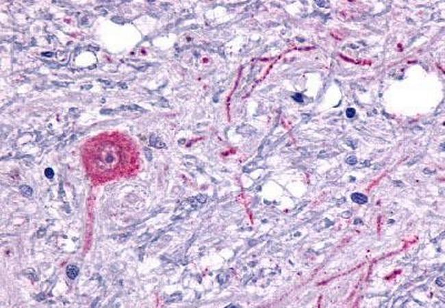 HTR6 Antibody in Immunohistochemistry (Paraffin) (IHC (P))