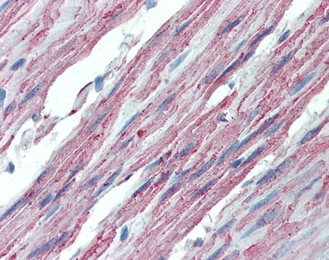 ITGA3 Antibody in Immunohistochemistry (Paraffin) (IHC (P))