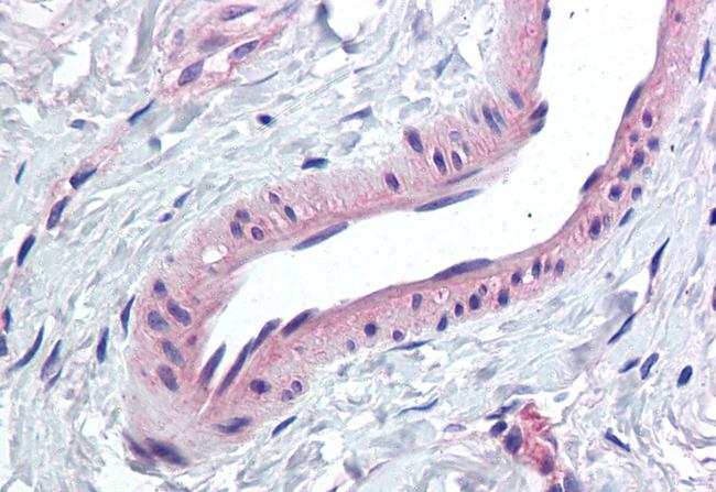 KCNMA1 Antibody in Immunohistochemistry (Paraffin) (IHC (P))