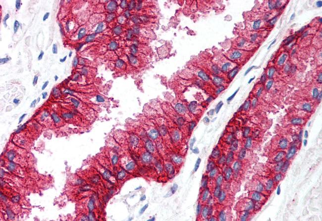 KCNN4 Antibody in Immunohistochemistry (Paraffin) (IHC (P))