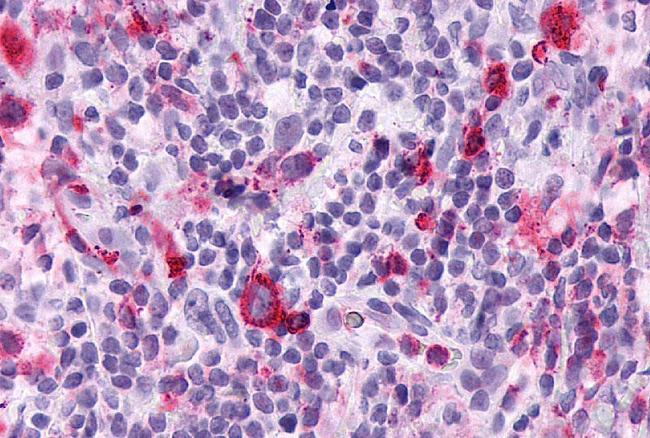 LTB4R Antibody in Immunohistochemistry (Paraffin) (IHC (P))