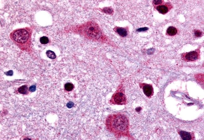 LGR4 Antibody in Immunohistochemistry (Paraffin) (IHC (P))