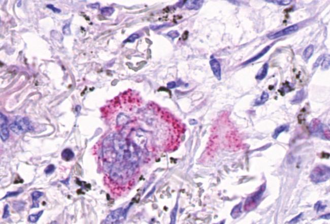 LGR4 Antibody in Immunohistochemistry (Paraffin) (IHC (P))