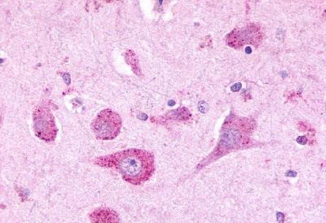 LPHN3 Antibody in Immunohistochemistry (Paraffin) (IHC (P))