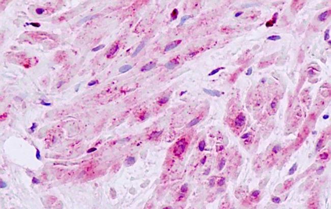 MLK1 Antibody in Immunohistochemistry (Paraffin) (IHC (P))