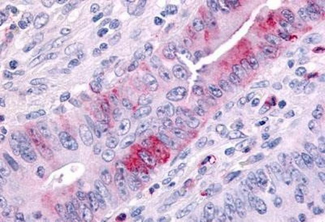 MLK1 Antibody in Immunohistochemistry (Paraffin) (IHC (P))