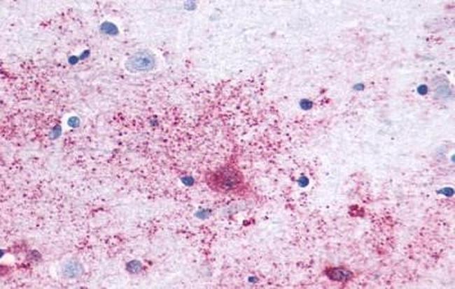 MAS1 Antibody in Immunohistochemistry (Paraffin) (IHC (P))