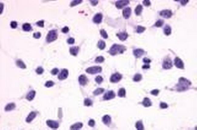 MC4R Antibody in Immunocytochemistry (ICC/IF)