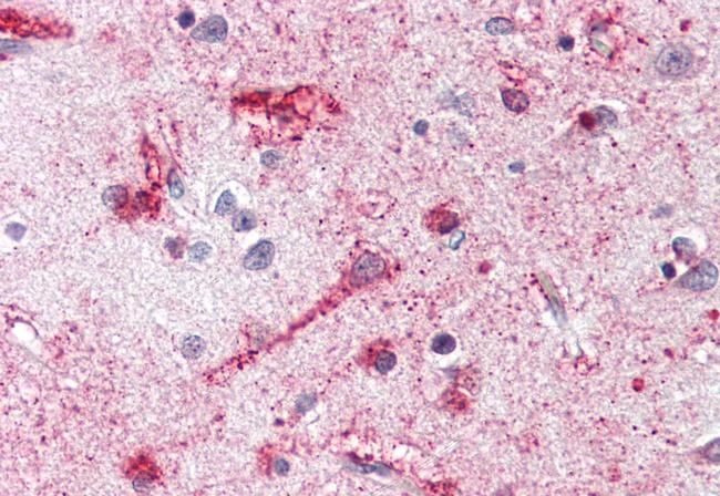 MC4R Antibody in Immunohistochemistry (Paraffin) (IHC (P))