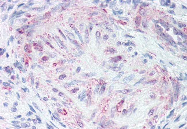 MLNR Antibody in Immunohistochemistry (Paraffin) (IHC (P))