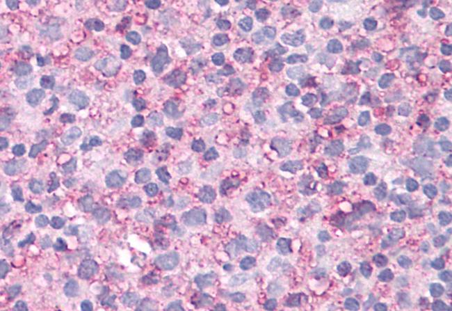 NEK6 Antibody in Immunohistochemistry (Paraffin) (IHC (P))