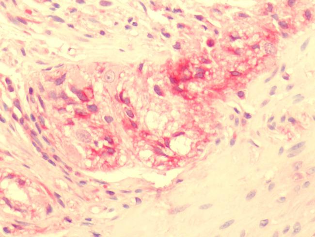 NPY2R Antibody in Immunohistochemistry (Paraffin) (IHC (P))