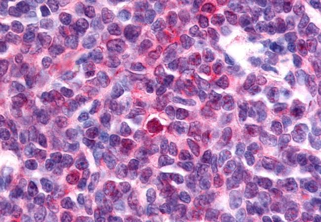 NOR-1 Antibody in Immunohistochemistry (Paraffin) (IHC (P))