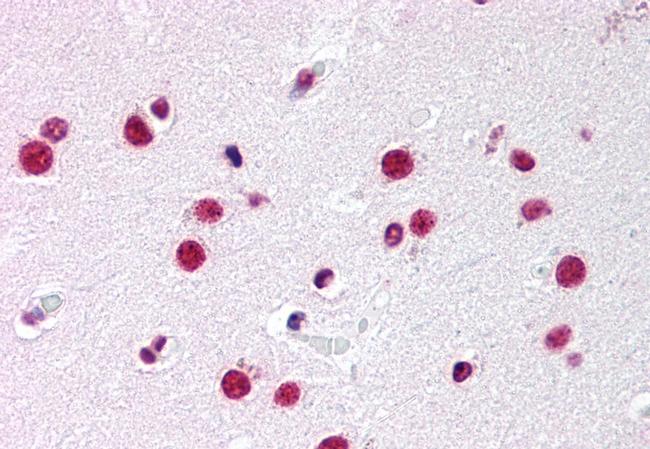 NR5A1 Antibody in Immunohistochemistry (Paraffin) (IHC (P))