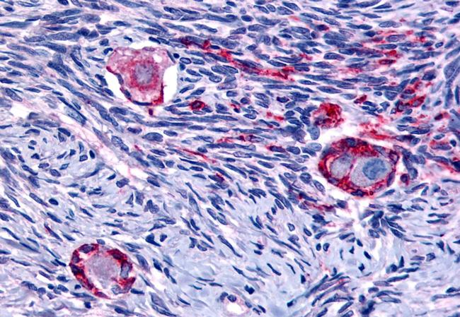 NR4A1 Antibody in Immunohistochemistry (Paraffin) (IHC (P))