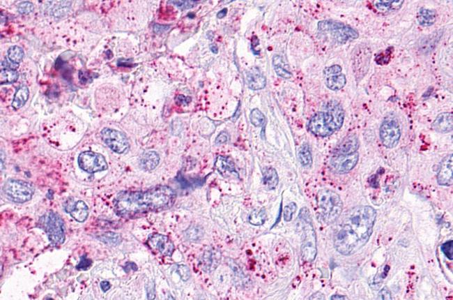 OXER1 Antibody in Immunohistochemistry (Paraffin) (IHC (P))