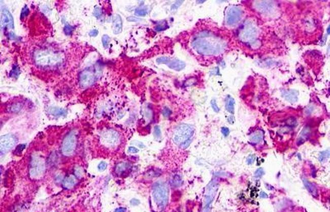 P2Y1 Antibody in Immunohistochemistry (Paraffin) (IHC (P))