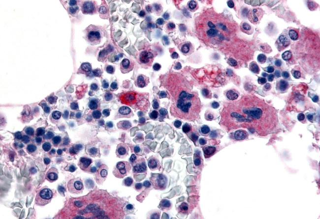 P2Y12 Antibody in Immunohistochemistry (Paraffin) (IHC (P))