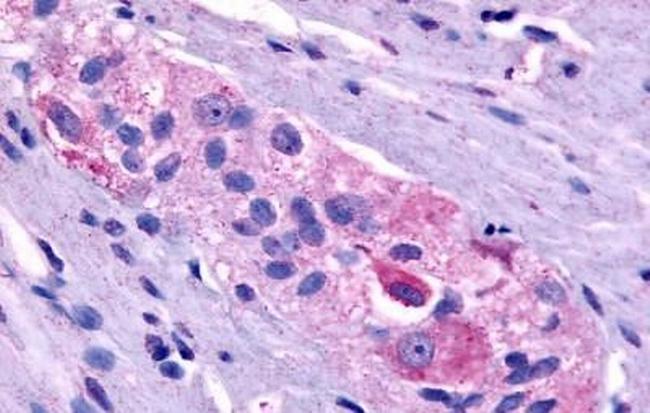 Prokineticin Receptor 1 Antibody in Immunohistochemistry (Paraffin) (IHC (P))